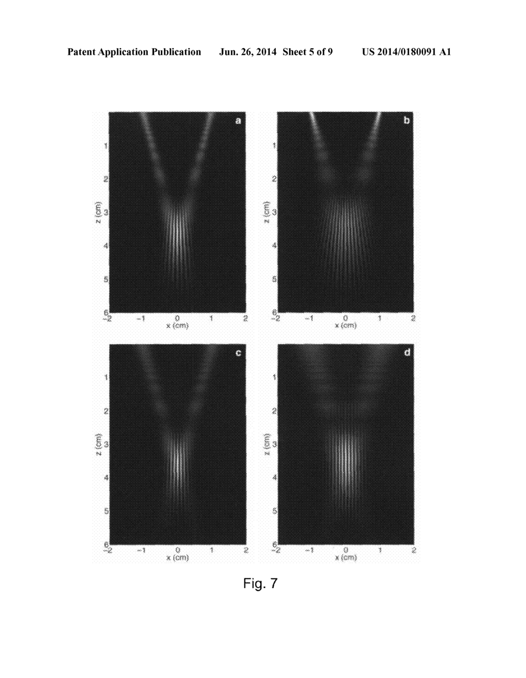 Shear-Modulus Estimation by Application of Spatially Modulated Impulse     Acoustic Radiation Force Approximation - diagram, schematic, and image 06