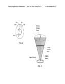 Catheter Assembly with a Shortened Tip diagram and image