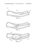 CATHETER WITH BALLOON AND IMAGING diagram and image