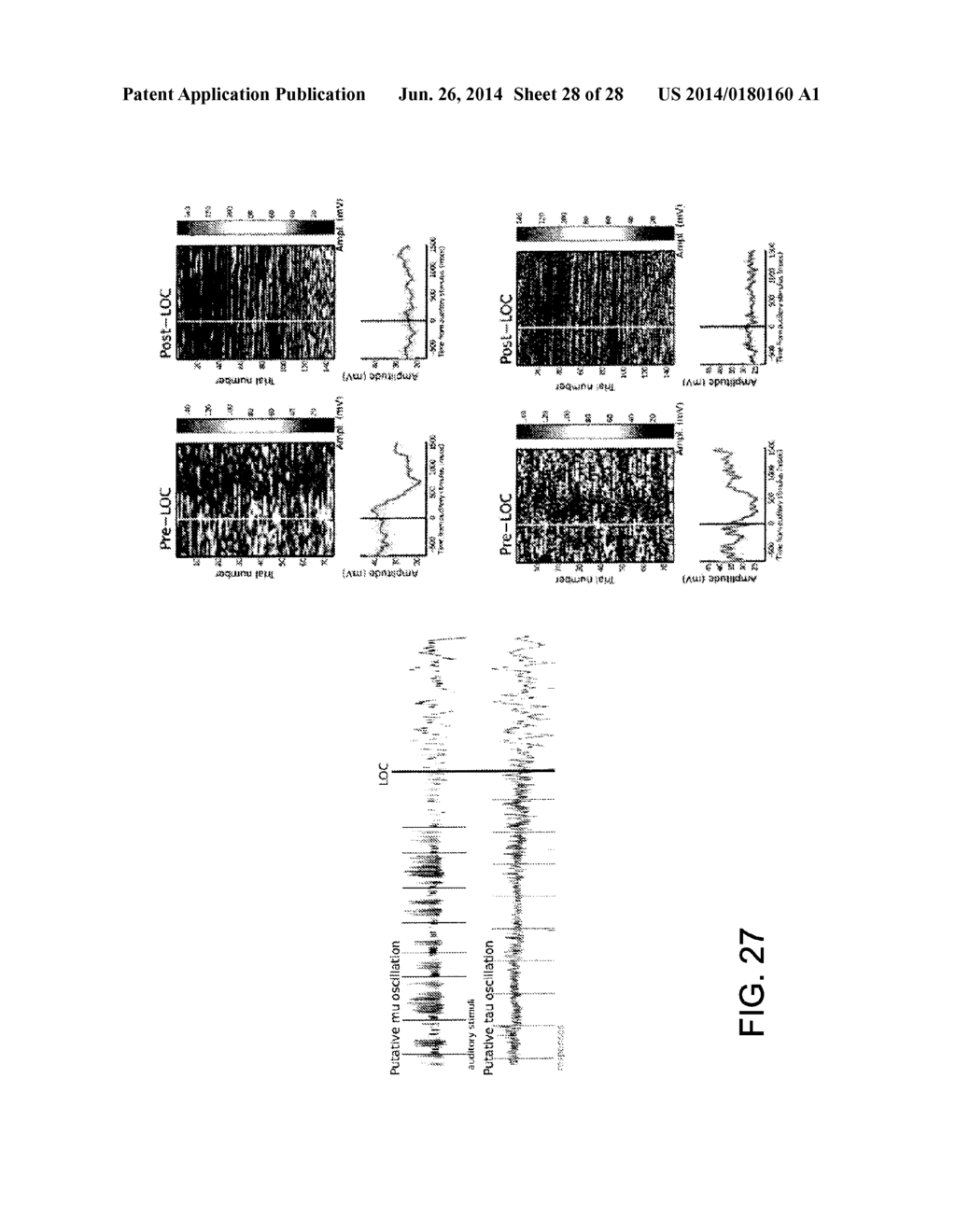 SYSTEM AND METHOD FOR MONITORING AND CONTROLLING A STATE OF A PATIENT     DURING AND AFTER ADMINISTRATION OF ANESTHETIC COMPOUND - diagram, schematic, and image 29