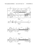 TARGETABLE BIOPSY NEEDLE SET AND METHOD OF USING SAME diagram and image