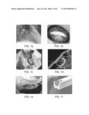 TUNED RF ENERGY AND ELECTRICAL TISSUE CHARACTERIZATION FOR SELECTIVE     TREATMENT OF TARGET TISSUES diagram and image