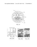 TUNED RF ENERGY AND ELECTRICAL TISSUE CHARACTERIZATION FOR SELECTIVE     TREATMENT OF TARGET TISSUES diagram and image