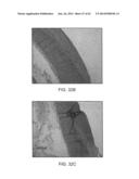 TUNED RF ENERGY AND ELECTRICAL TISSUE CHARACTERIZATION FOR SELECTIVE     TREATMENT OF TARGET TISSUES diagram and image