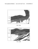 TUNED RF ENERGY AND ELECTRICAL TISSUE CHARACTERIZATION FOR SELECTIVE     TREATMENT OF TARGET TISSUES diagram and image