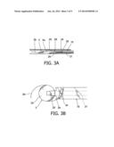 Intraocular Lens Insertion Device diagram and image