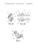 Intraocular Lens Insertion Device diagram and image