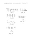 ELECTROSTIMULATION IN TREATING CEREBROVASCULAR CONDITIONS diagram and image