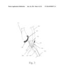 ELECTROSTIMULATION IN TREATING CEREBROVASCULAR CONDITIONS diagram and image