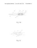 ELECTROSTIMULATION IN TREATING CEREBROVASCULAR CONDITIONS diagram and image