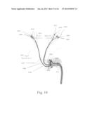 ELECTROSTIMULATION IN TREATING CEREBROVASCULAR CONDITIONS diagram and image