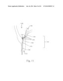 ELECTROSTIMULATION IN TREATING CEREBROVASCULAR CONDITIONS diagram and image