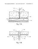 ARTICULATING SUTURING DEVICE diagram and image