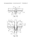 ARTICULATING SUTURING DEVICE diagram and image