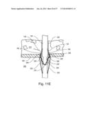 ARTICULATING SUTURING DEVICE diagram and image