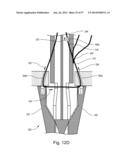 ARTICULATING SUTURING DEVICE diagram and image