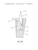 ARTICULATING SUTURING DEVICE diagram and image