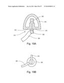 ARTICULATING SUTURING DEVICE diagram and image