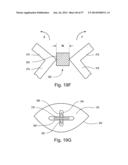 ARTICULATING SUTURING DEVICE diagram and image