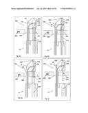 Suture Passing Instrumentation and Methods of use Thereof diagram and image