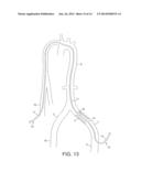 ROTATIONAL ATHERECTOMY DEVICE WITH DISTAL EMBOLIC PROTECTION diagram and image