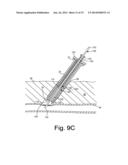 APPARATUS AND METHODS FOR SEALING A VASCULAR PUNCTURE diagram and image