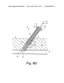 APPARATUS AND METHODS FOR SEALING A VASCULAR PUNCTURE diagram and image