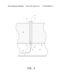 APPARATUS FOR CLOSING VASCULAR PUNCTURE diagram and image