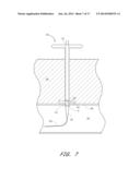 APPARATUS FOR CLOSING VASCULAR PUNCTURE diagram and image