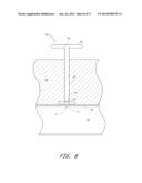 APPARATUS FOR CLOSING VASCULAR PUNCTURE diagram and image