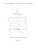 APPARATUS FOR CLOSING VASCULAR PUNCTURE diagram and image