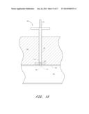 APPARATUS FOR CLOSING VASCULAR PUNCTURE diagram and image