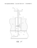 APPARATUS FOR CLOSING VASCULAR PUNCTURE diagram and image