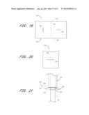 APPARATUS FOR CLOSING VASCULAR PUNCTURE diagram and image