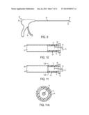 SYSTEM FOR SECURING SUTURES diagram and image