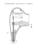 SYSTEM FOR SECURING SUTURES diagram and image