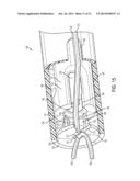 SYSTEM FOR SECURING SUTURES diagram and image