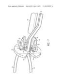 SYSTEM FOR SECURING SUTURES diagram and image