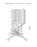 SYSTEM FOR SECURING SUTURES diagram and image