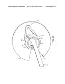 SYSTEM FOR SECURING SUTURES diagram and image