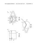 SYSTEM FOR SECURING SUTURES diagram and image