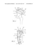 MODULAR AND NON-MODULAR CORTICAL BUTTRESS DEVICE diagram and image