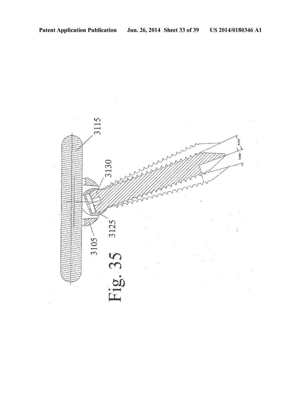 DEVICES AND METHODS FOR DYNAMIC FIXATION OF SKELETAL STRUCTURE - diagram, schematic, and image 34