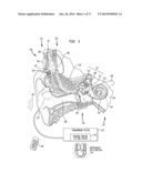 RECORDING AND RETRIEVAL OF SOUND DATA IN A HEARING PROSTHESIS diagram and image