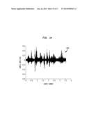 RECORDING AND RETRIEVAL OF SOUND DATA IN A HEARING PROSTHESIS diagram and image