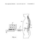 SYMMETRICAL OUTPUT NEUROSTIMULATION DEVICE diagram and image