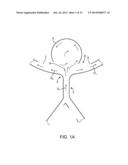 ANEURYSM OCCLUSION SYSTEM AND METHOD diagram and image