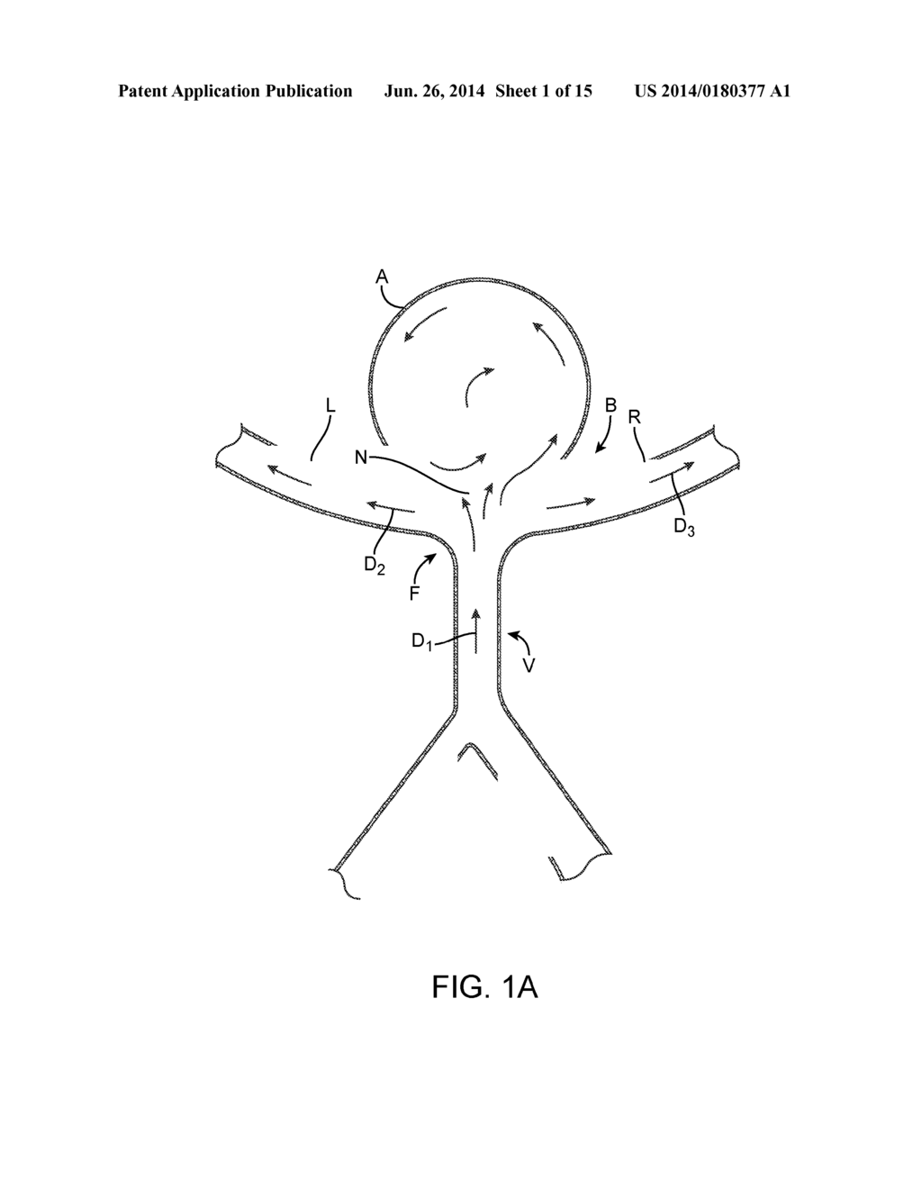 ANEURYSM OCCLUSION SYSTEM AND METHOD - diagram, schematic, and image 02