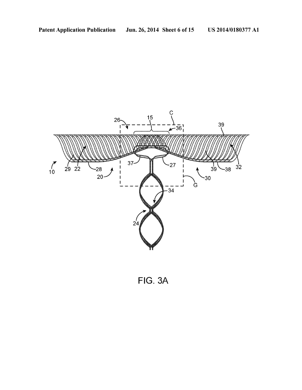 ANEURYSM OCCLUSION SYSTEM AND METHOD - diagram, schematic, and image 07