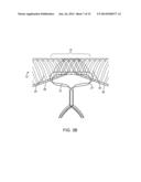 ANEURYSM OCCLUSION SYSTEM AND METHOD diagram and image